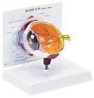 2750 Gpi New Anatomical Human Eye Cornea Model Wow 700358304729