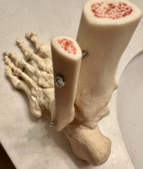 A31l 3b Scientific Anatomical Skeleton Foot Left Rigid With Wire Tibia Fibula New