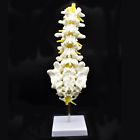 43217-52243 Shawn Science Medical Human Lumbar Spine Demonstration Model Anatomical Verteb