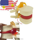 670036 Carejoy New Sale Medical Teach Lumbar Spine Model 190891300010