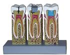 700358306075 Medical Demodent Anatomical Dentist Dental Teeth Tooth Model