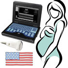 Cms600p2 Contec Laptop Ultrasound Scanner Convex Diagnostic Systems Us Fedex