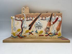 0185-00 Denoyer Geppert Human Skin Series With Burn Pathologies Anatomical Model