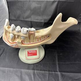 W42516 Denoyer Geppert Half Lower Jaw 3.5 Times Full-size 5 Part Model Missing 2 Teeth