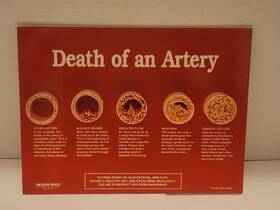 79149 Health Edco Education - Death Of An Artery Display