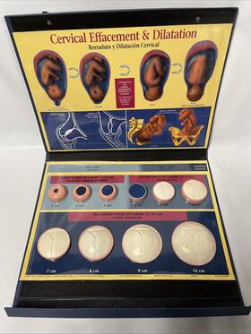79700 Health Edco Education - Cervical Effacement And Dilation Model
