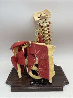 Bp1500deluxe Medical Plastics Laboratory Vintage Brachial Plexusanatomical Model