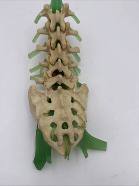 Slv-4015 Medical Plastics Laboratory Deluxe Lumbar Spine Anatomical Model