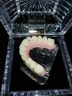 Overdenture All On 5 Kilgore Maxillary Implant Demo Model Dental Max