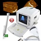 Rus-6000a Carejoy Ultrasonic Digital Ultrasound Scanner Machine Curve Transvaginal 190891236289