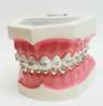 Tr-14 Kilgore Vintage Dental Study Model With Braces
