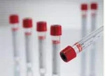 Vacuette Z Serum Clot Activator Venous Blood Collection Tube Addi. Fixed Price $228.08.