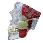 Tmj - Temporomandibular Joint Anatomical Model Gpi Lfa #2880 Video Make Offer!. Fixed Price $138.15.