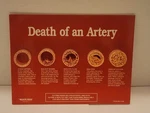 Health Edco Education - 79149 Death Of An Artery Display. Fixed Price $65.00.