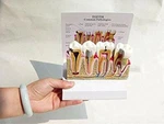 Anatomical Diseased Teeth And Gums Model-dental Hygiene Tooth Medical Anatomy Ce. Fixed Price $54.99.