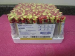 Bd Vacutainer Ref 364992 8ML Urine Analysis Preservative Tube 100 Pack EX10/2025. Fixed Price $39.95.