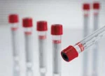 Vacuette Z Serum Clot Activator Venous Blood Collection Tube Addi. Fixed Price $175.31.