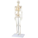 Axis Scientific Mini Human Skeleton Model With Metal Stand, 31" Tall Rem.... Fixed Price $114.85.