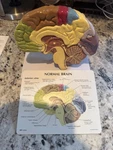 Brain Half Sectioned Gpi Model W Key Card Lfa #2950 Make Us An Offer! See Video. Fixed Price $75.00.