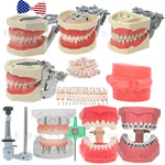 Dental Typodont Teeth Implant Model Pathological Perio Restoration Practice Demo. Fixed Price $19.99.