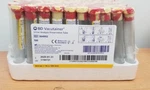 16X100 8ML Y Top Tubes. Fixed Price $19.99.