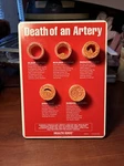 Health Edco Education - 79149 Death Of An Artery Display. Fixed Price $75.00.