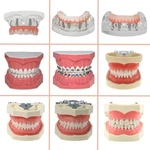Dental Typodont Model Overdenture Ortho Brushing Practice Teaching. Fixed Price $32.89.