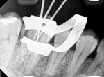 Carestream Rvg 6200 Dental Digital Sensor Size ( Read Details + Images). Fixed Price $1600.00.
