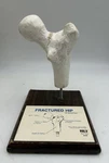 Health Edco Fractured Hip Femur Bone Education Anatomical Model. Fixed Price $29.00.