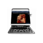 Chison EBIT30 Ultrasound With 4D And Hd Function Volumetric Probe. Fixed Price $19999.00.