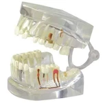 Teeth Clear Human Jaw Anatomical Model Gpi Lfa #2861 - Free Shipping!!. Fixed Price $84.99.
