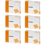 Smith & Nephew Cuticerin Sterile Gauze Dressing, 3" X Pads - Case Of 300. Fixed Price $110.00.